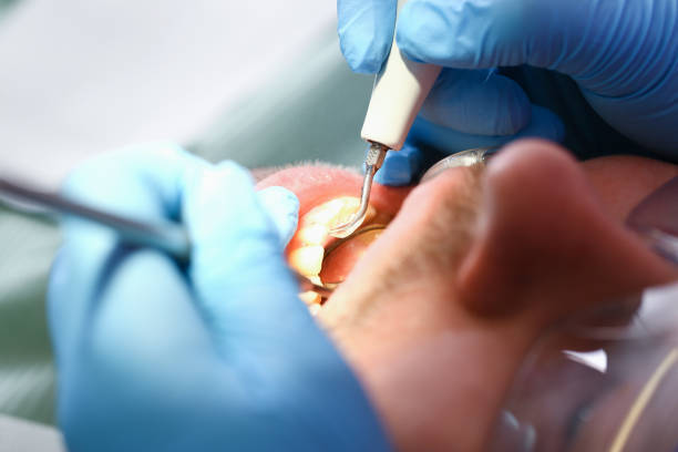 Best Broken or Cracked Tooth Emergency Dentist in Graham, NC