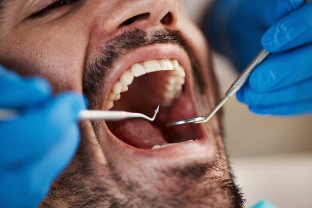 Best Broken or Cracked Tooth Emergency Dentist in Graham, NC