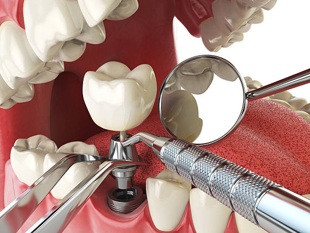 Best Urgent Dental Care for Toothache in Graham, NC