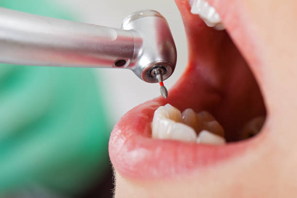 Best Emergency Dentist for Special Needs Patients in Graham, NC